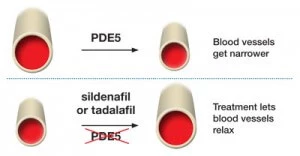 PDE5 vs Viagra (Sildenafil)