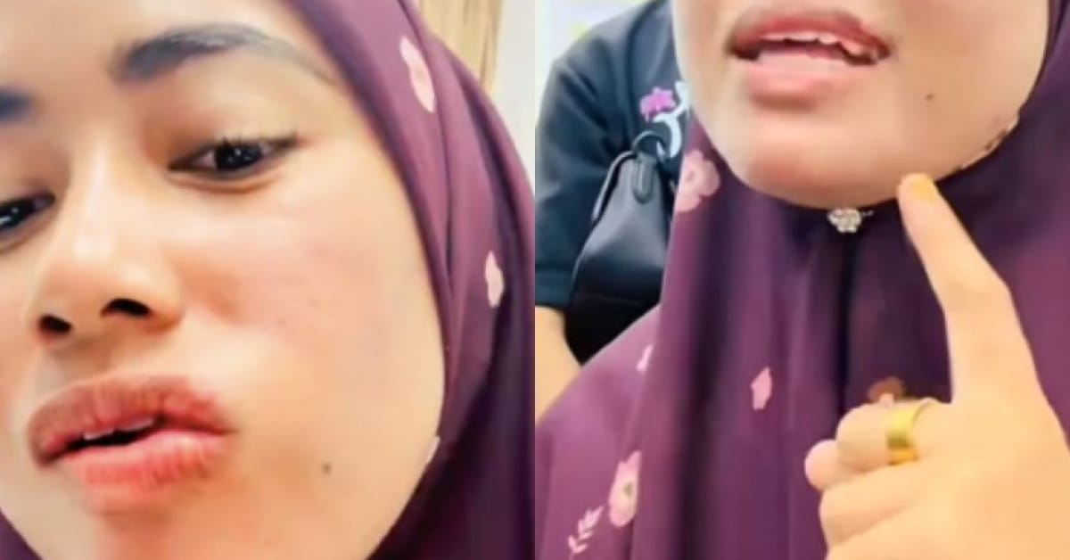 Mujarab-atau-mitos-miyak-lintah-belacak-dhab