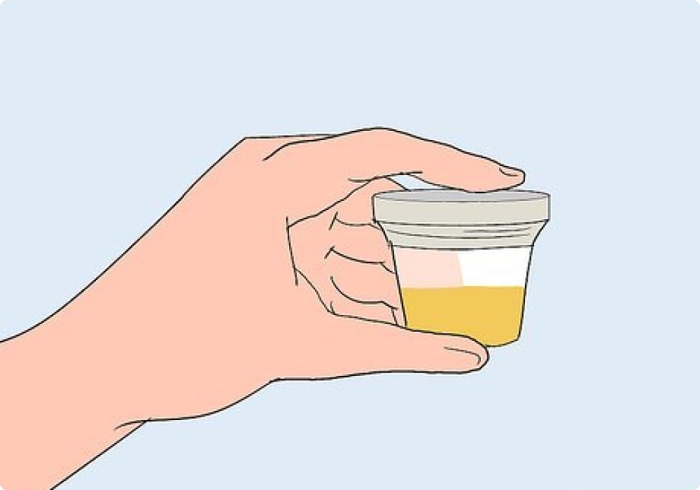 penyakit std di malaysia