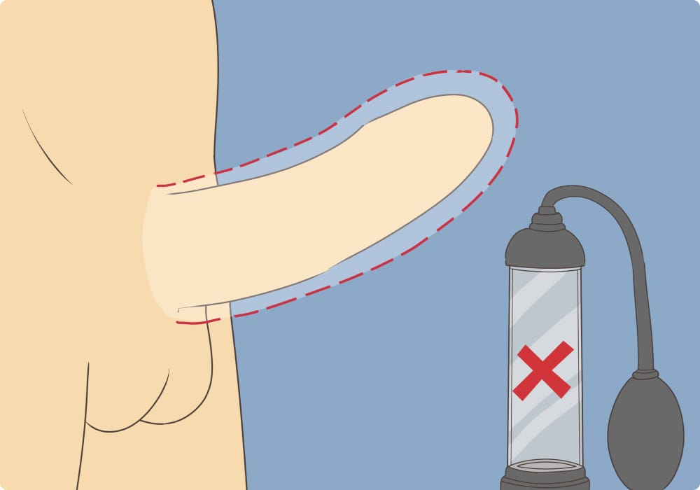 punca zakar tidak naik