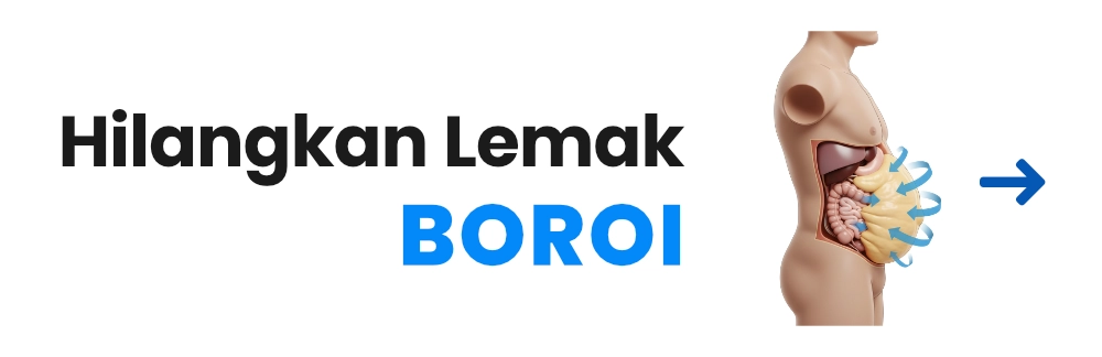 Rawatan Hilangkan lemak Boroi Rawatan Hilangkan lemak Boroi
