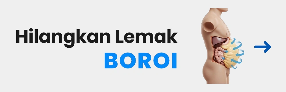 Servis Hilangkan Lemak Boroi di SuamiSihat Servis Hilangkan Lemak Boroi di SuamiSihat