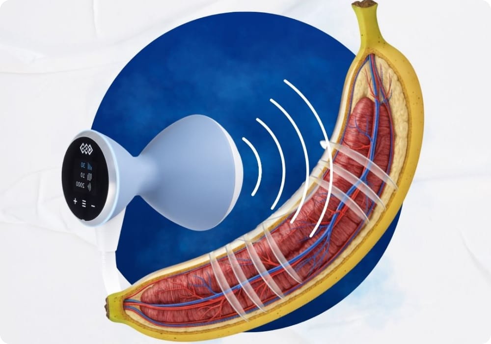 Penile Tissue Expansion Wave Protocol