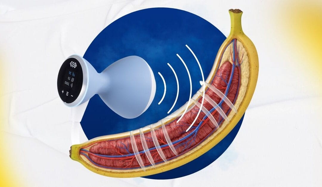 Penile Tissue Expansion Wave Protocol