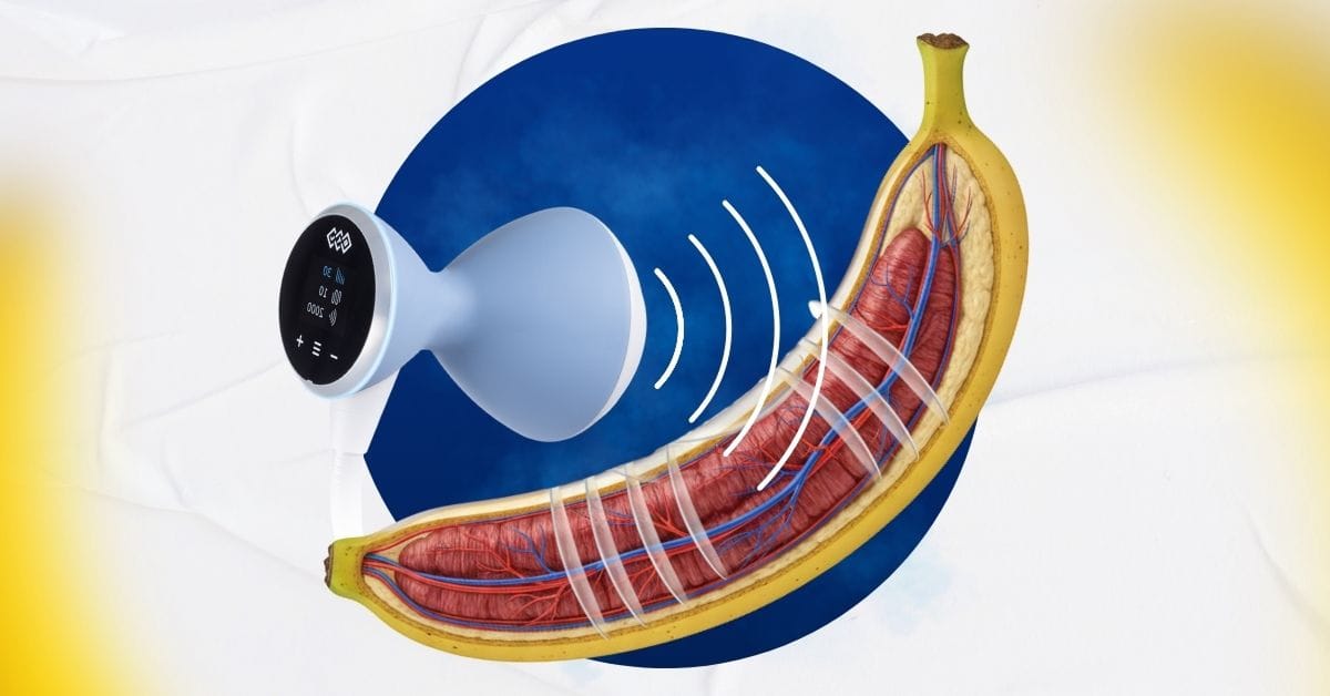 Penile Tissue Expansion Wave Protocol