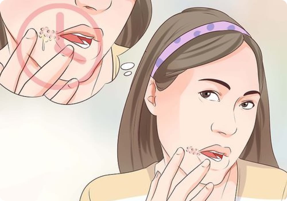 herpes dalam konteks malaysia