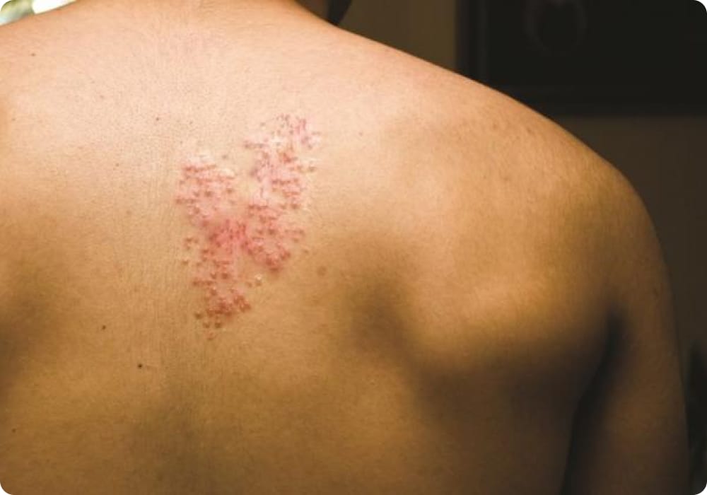 langgan servis urut boleh dapat penyakit