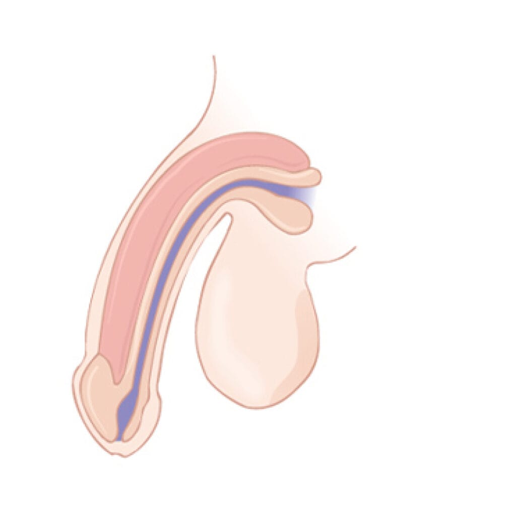 lelaki 30 tahun mati pucuk