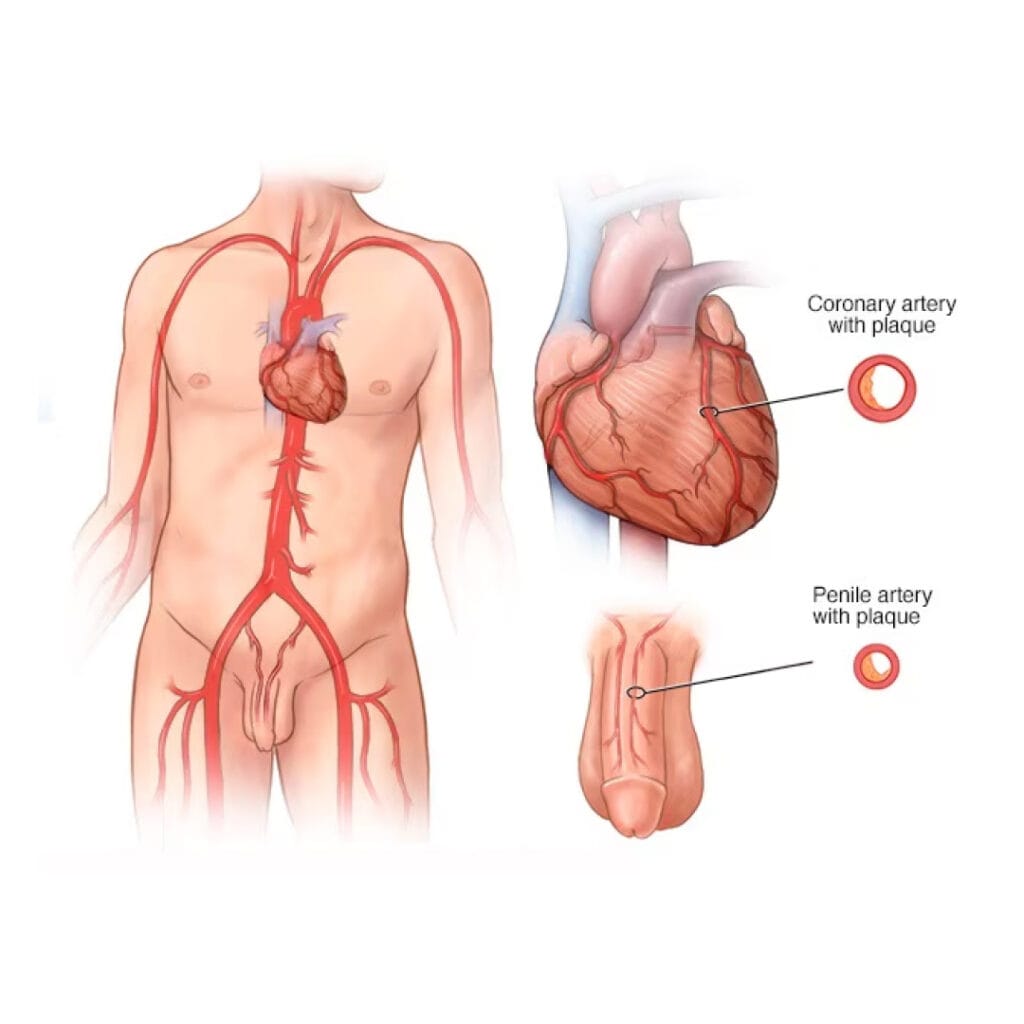 mati pucuk tanda penyakit kronik