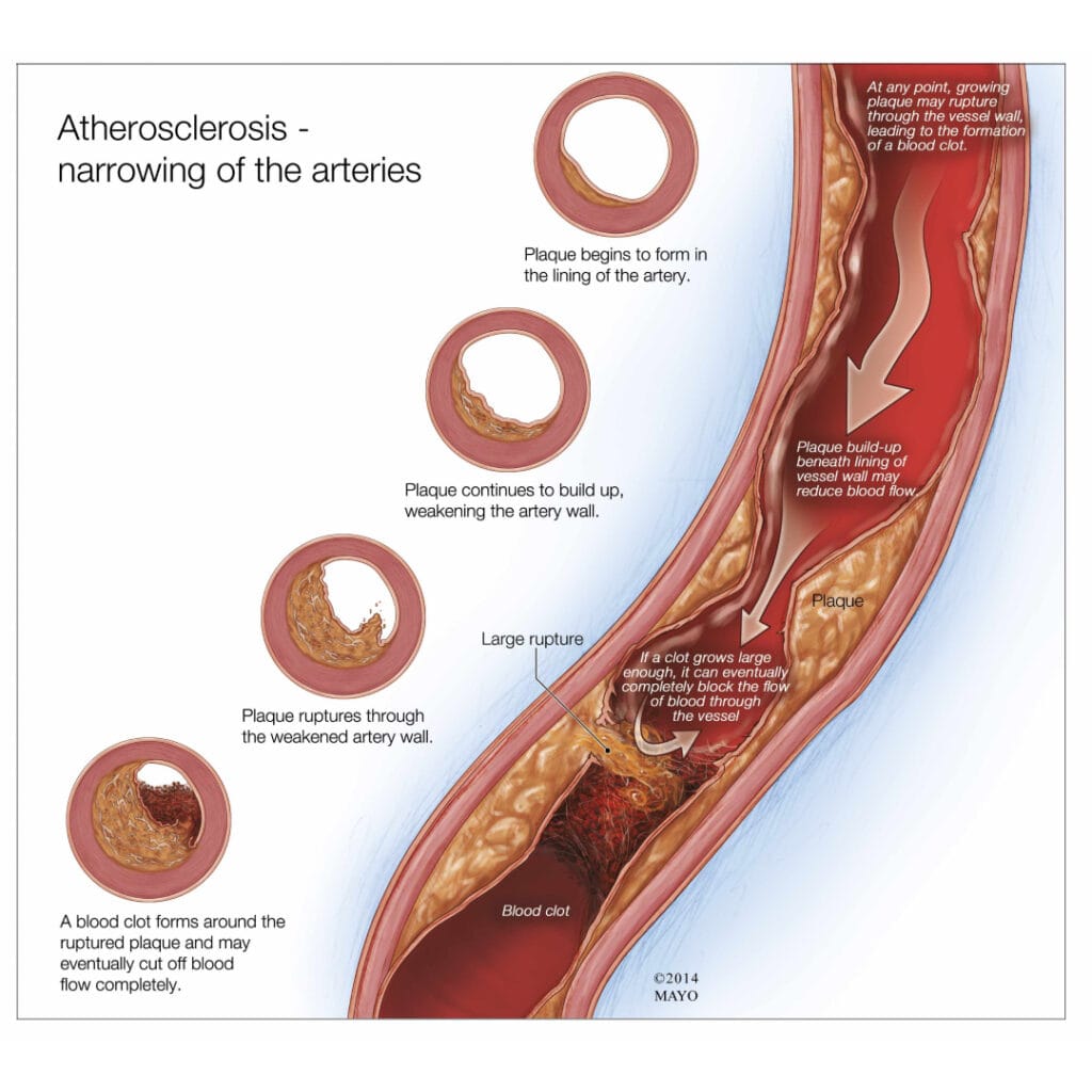 mati pucuk tanda penyakit kronik
