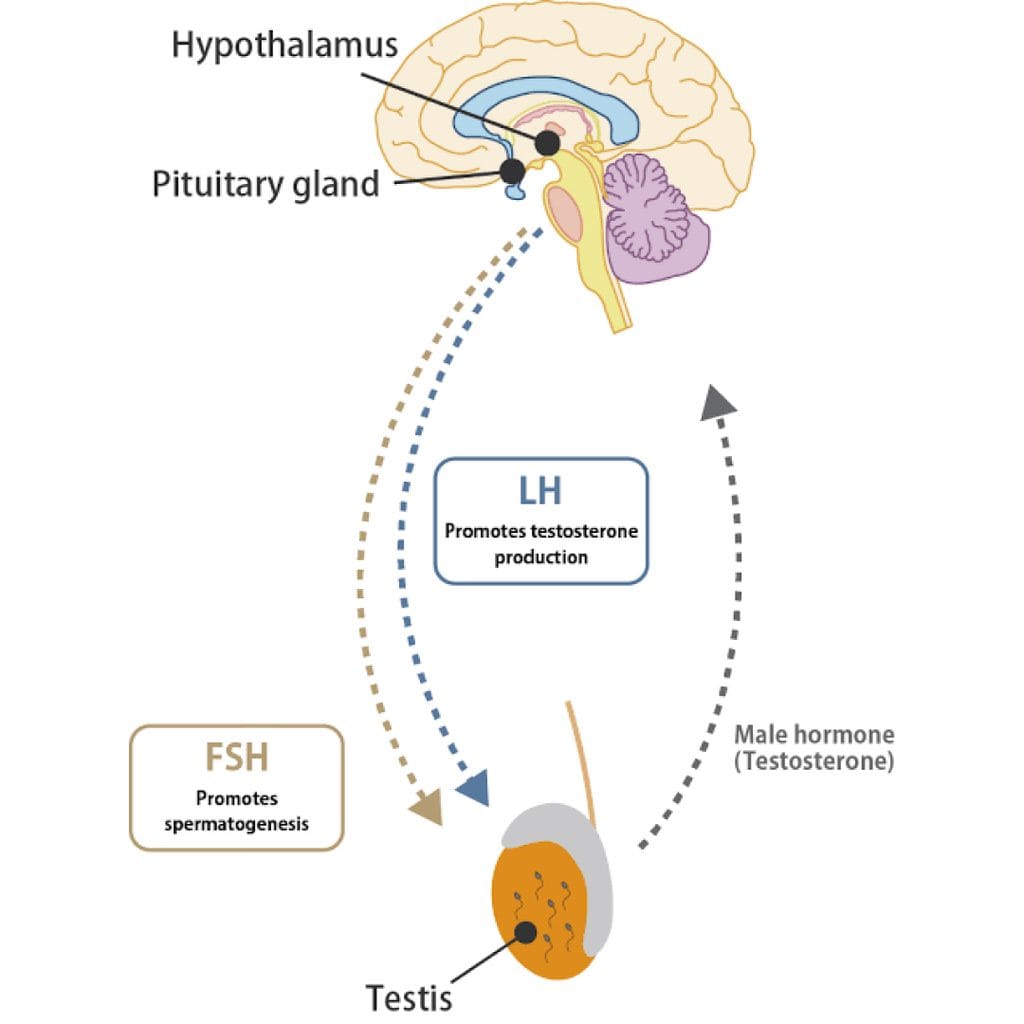 hormone imbalance