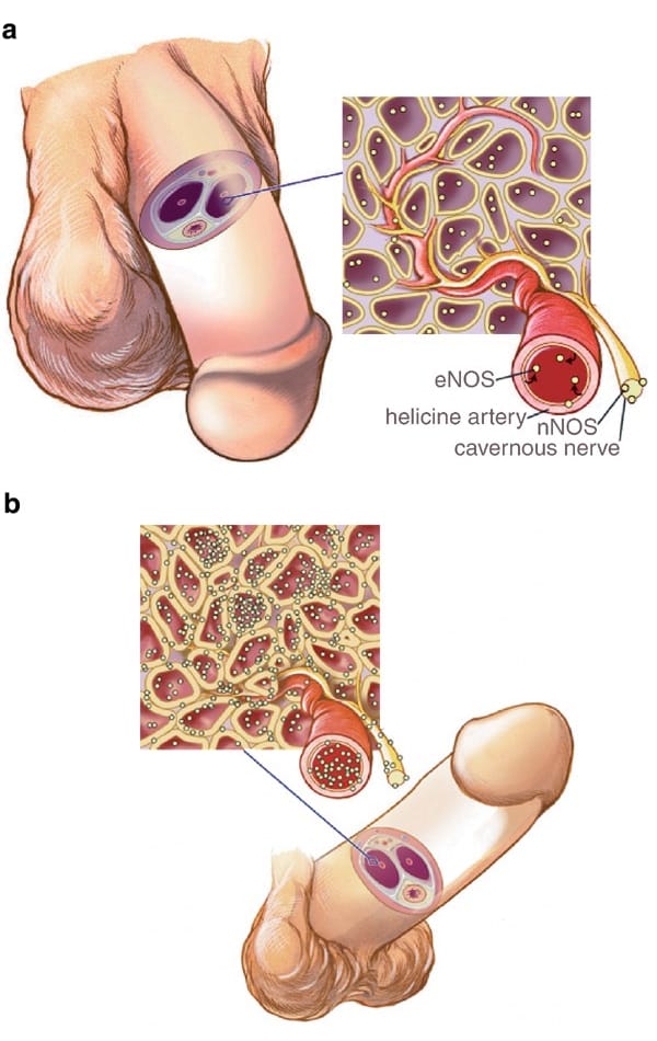 nitrite oxide therapy in malaysia